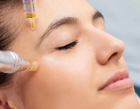 Collagen Induction Therapy