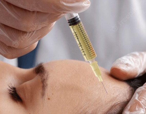 PRP (Platelet-Rich Plasma) Therapy