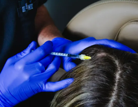 Hair Restoration Therapy