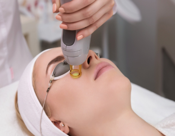 Fractional Laser Treatment
