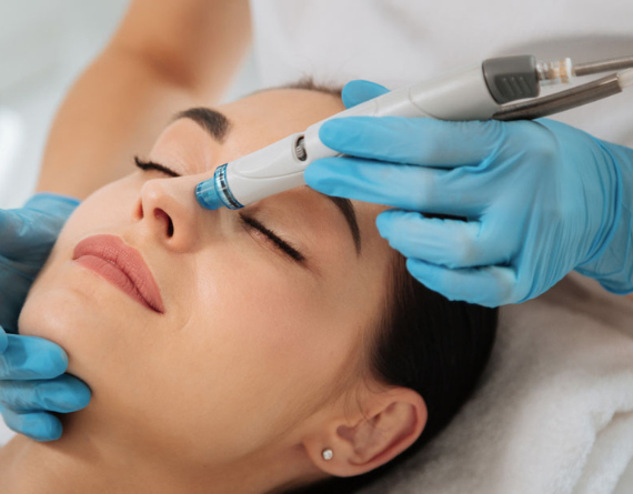 Thread Insertion & Lifting